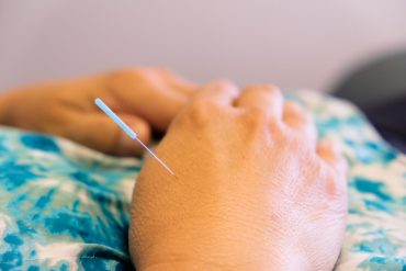 CAN ACUPUNCTURE TREAT DEPRESSION?