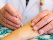 what acupuncture added to my practice of medicine